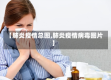 【肺炎疫情总图,肺炎疫情病毒图片】
